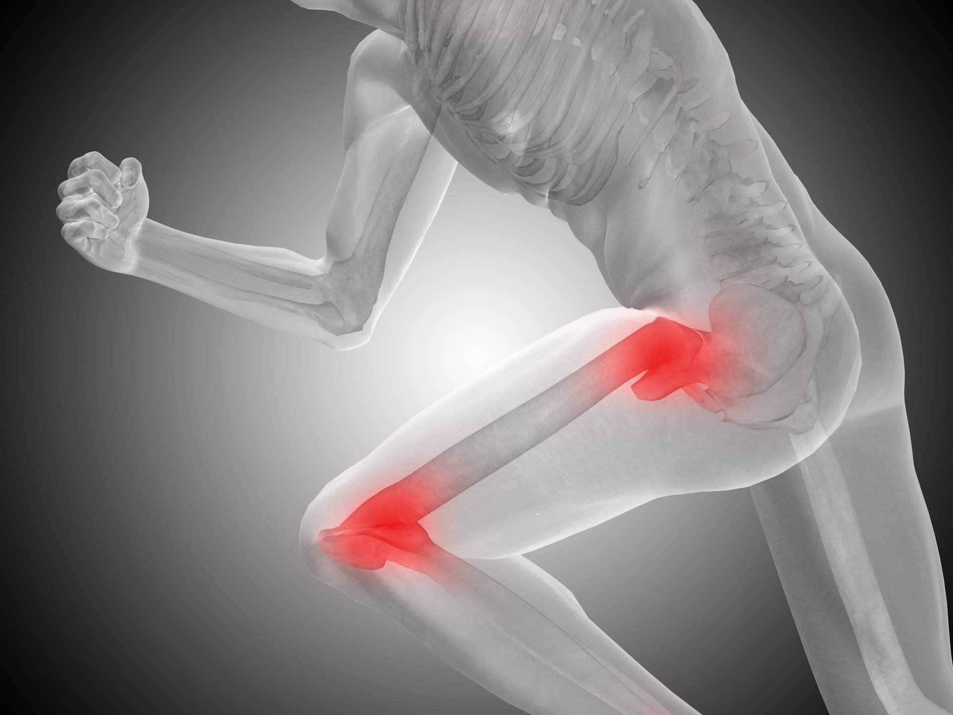 CBD para fisioterapia, las recomendaciones de CBD Wonderfull
